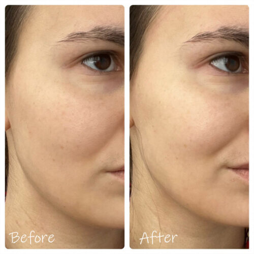 تونر سنتلا مدل HYALU-CICA Brightening حجم 210 میلی لیتر